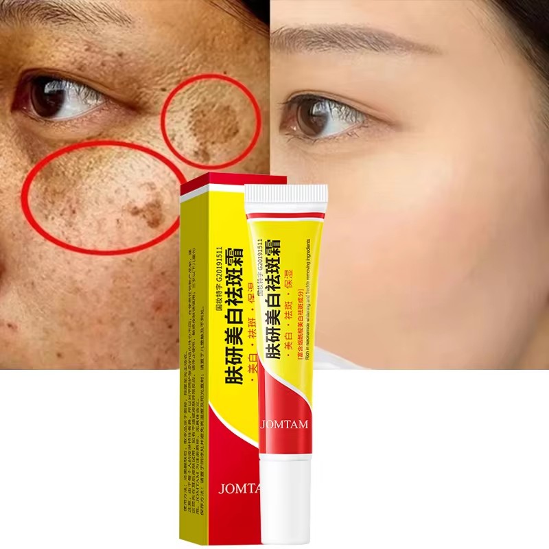 Skincare Glad2Glow - 美白そばかすクリーム顔の美白クリームナイアシンアミド肝斑を軽減メラニンフェード小じわ明るくダークスキンケア