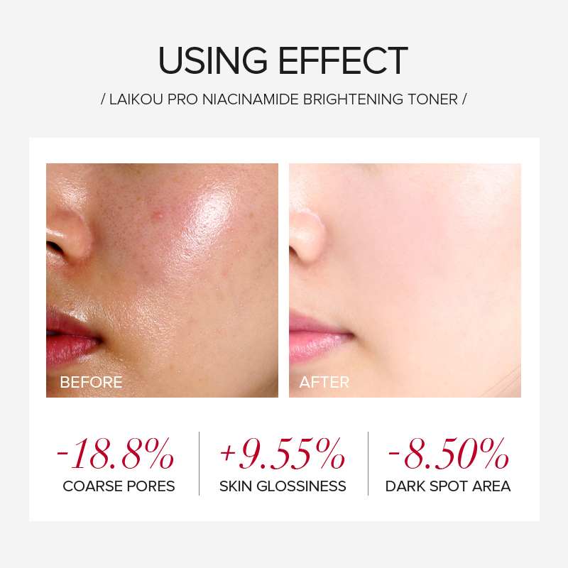 LAIKOU PRO ナイアシンアミド 4点セット ブライト - Skincare Routine のレビューと価格