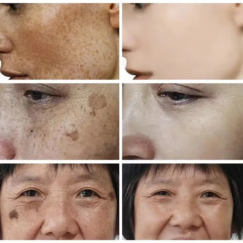 美白そばかすクリーム顔の美白クリームナイアシンアミド肝斑を軽 - Skincare Glad2Glow のレビューと価格