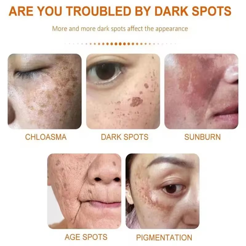 美白そばかすクリーム顔の美白クリームナイアシンアミド肝斑を軽 - Skincare Glad2Glow のレビューと価格