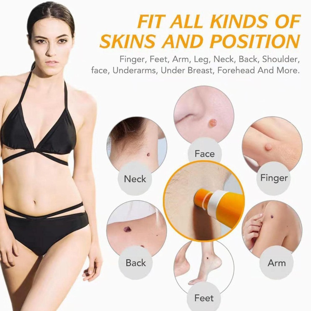 自動スキンタグ除去キット 小さなスキンタグから大きなスキンタ - Skincare Ingredients Checker のレビューと価格