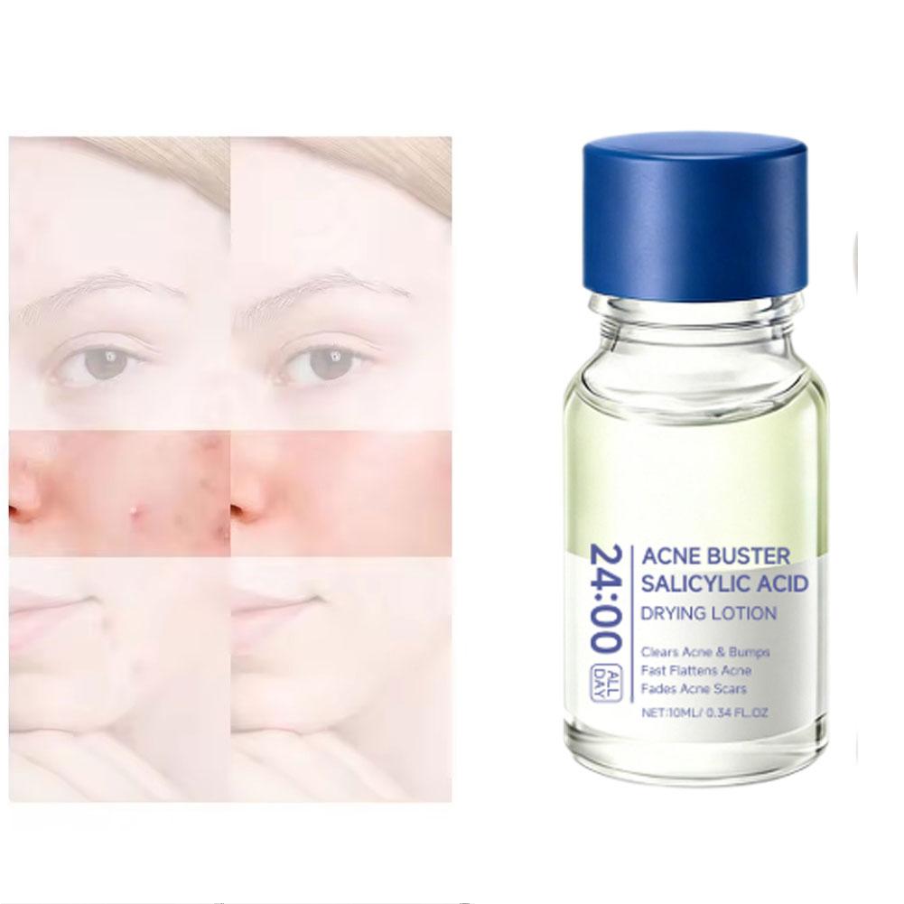 サリチル酸エッセンス配合トリートメントローション、乾燥肌用ロ - Tranexamic Acid Serum のレビューと価格