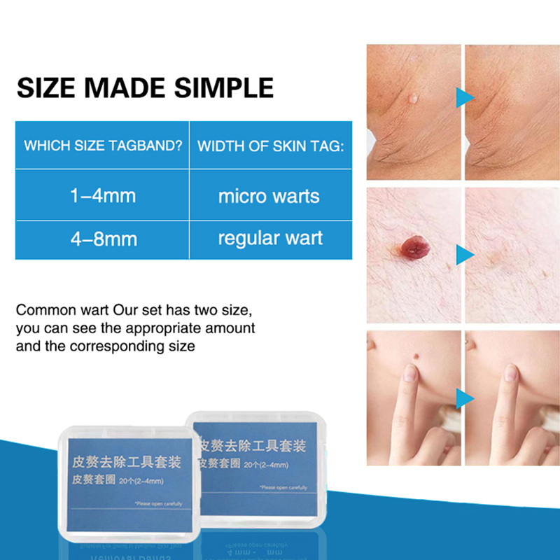 20個入り/箱 肉色の母斑除去バンド 無毒のモールゴムキット - Skincare Ingredients Checker のレビューと価格
