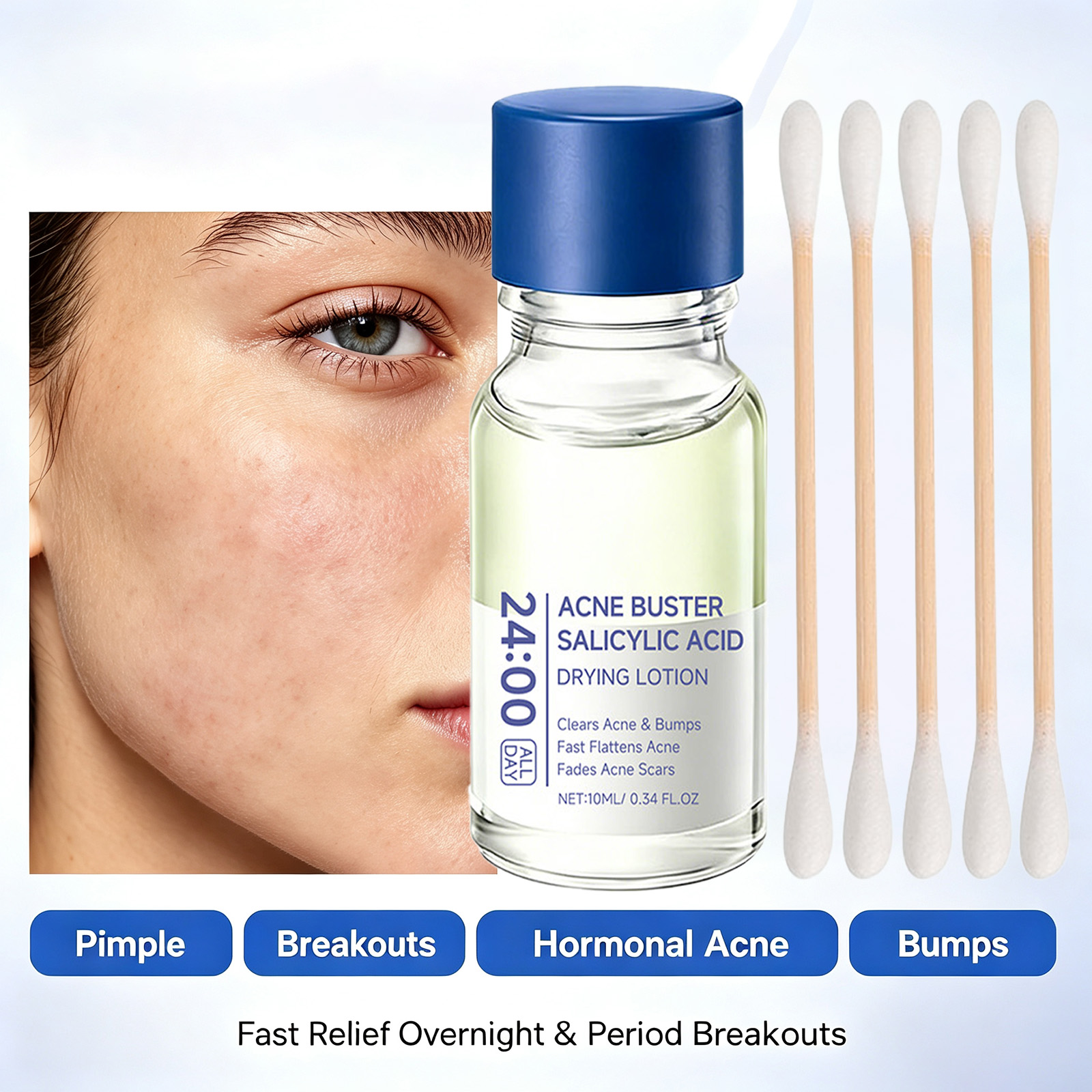 サリチル酸配合ニキビ治療美容液、ナイアシンアミド配合ニキビ跡 - Tranexamic Acid Serum のレビューと価格